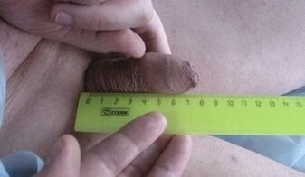 measuring the size of the penis